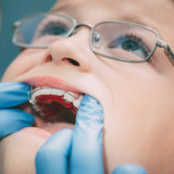 Formations pour devenir orthodontiste